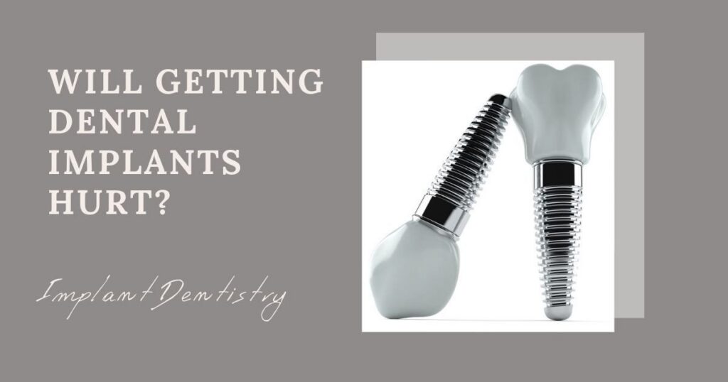 Will Getting Dental Implants Hurt