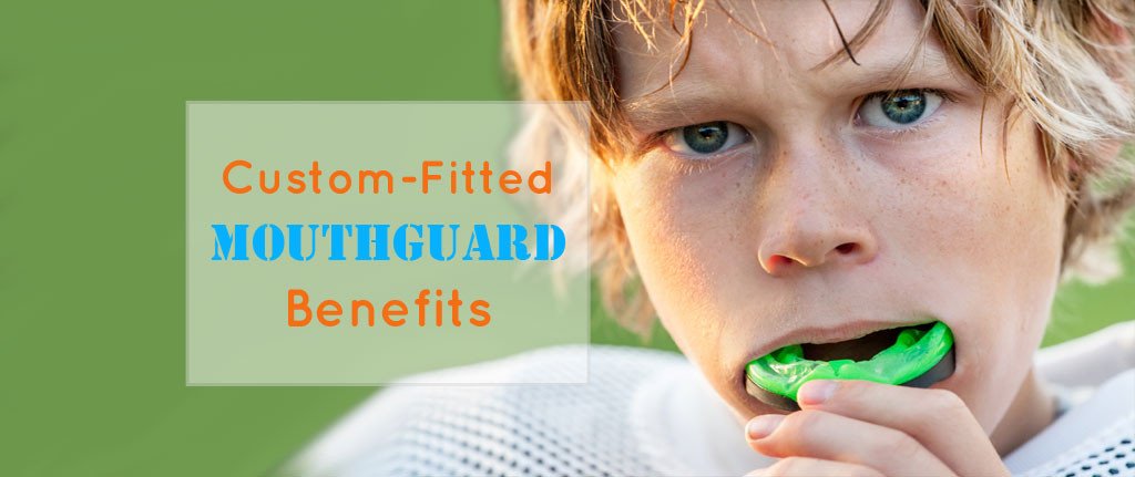 Custom Fitted Mouth Guards