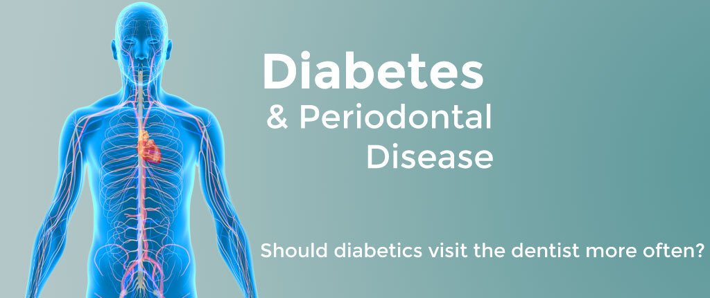 Diabetes Periodontal Disease